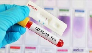 Heboh di Medsos Rapid Test Satu Bidang di Diskominfo Postif Corona, Ini Keterangan Jubir Gugus Tugas Paijo