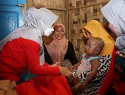 Winarni Nanang Ermanto Berikan Bantuan dan Santunan Kepada Anak Yang Mengalami Kelainan Kulit