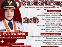 Pemkot Bandarlampung buka layanan operasi bibir sumbing gratis