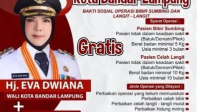 Pemkot Bandarlampung buka layanan operasi bibir sumbing gratis