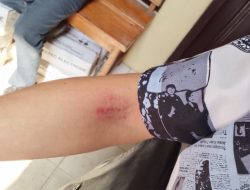 Bergaya Preman Oknum Pengawas Proyek Mengkroyok dua jurnalis Saat Meliput Gapura Kampus UIN RIL